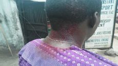 PDP member stabbed in Benin