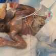 Baby Miracle