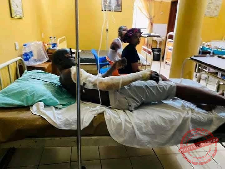 v3 Port Harcourt Gas Explosion Victims Die