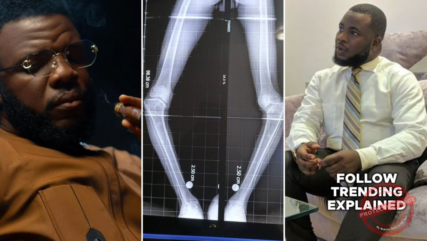 Wizarab and x-ray of the legs
